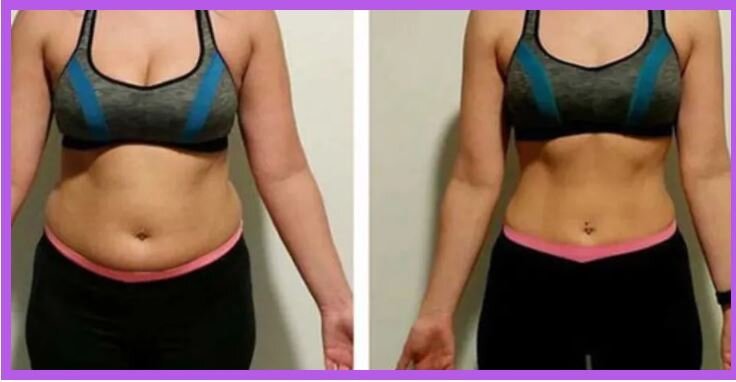 Body sculpting before and after